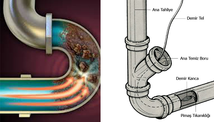 pimaş tıkanıklığı açma
